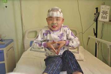 小孩初期无痛人流是什么症状