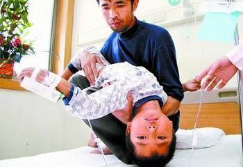 无痛人流病的常规检查