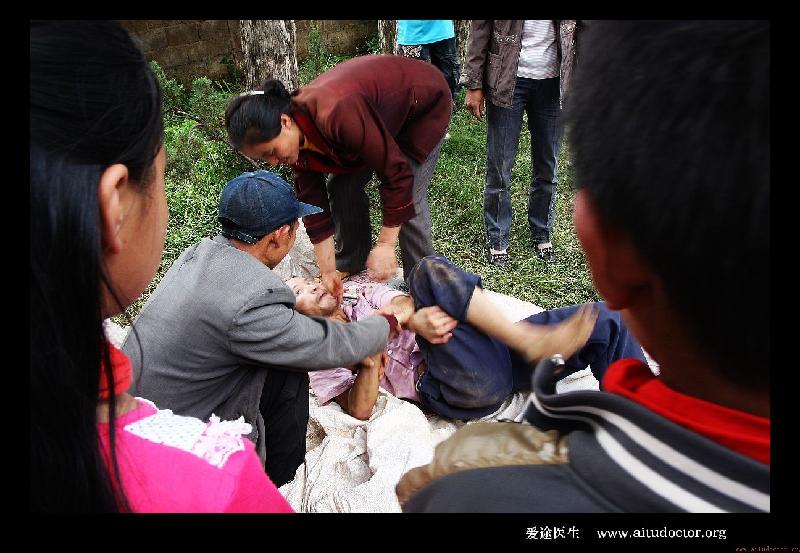 无痛人流药物治疗误区
